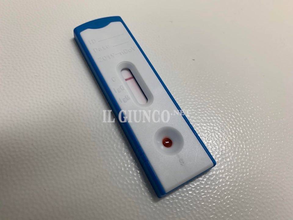 Test sierologici coronavirus 2020