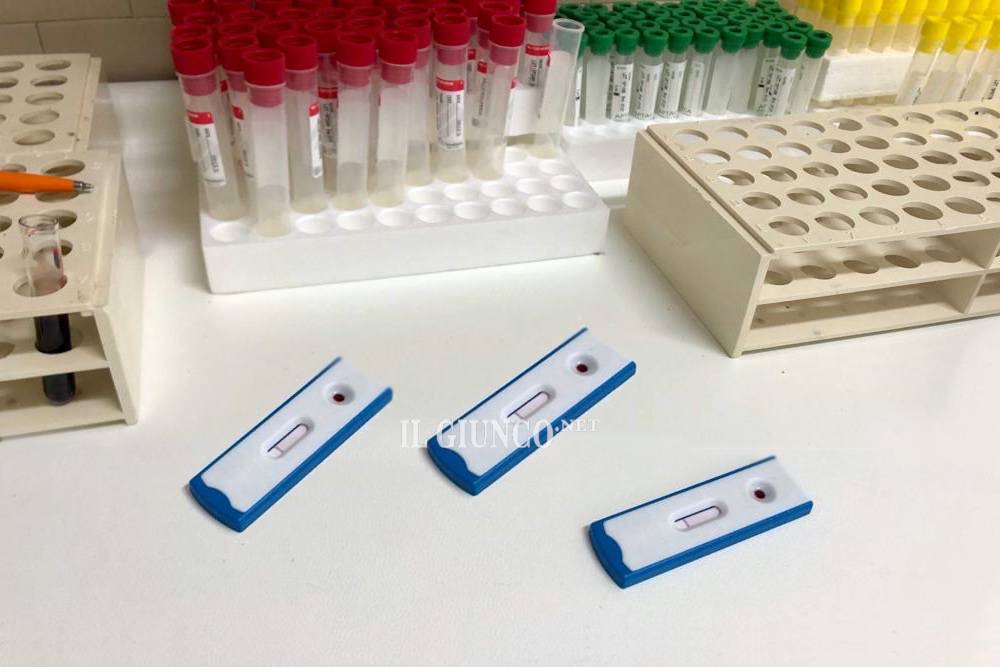 test sierologici Coronavirus 2020
